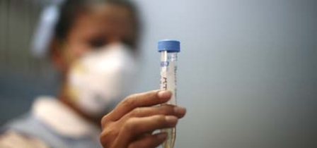 Swine Flu hits in Chenango County